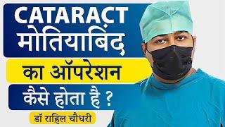 मोतियाबिंद (Cataract) का ऑपरेशन कैसे किया जाता है? | Step-By-Step Process of Cataract Surgery