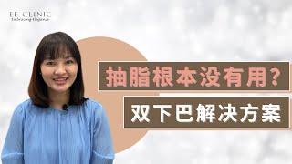 【抽脂根本没有用？双下巴解决方案】