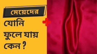 মেয়েদের যোনি ফুলে যায় কেন?