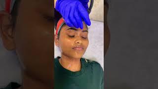 ANTI AGING FACE CUPPING#shorts#trending#face#facecupping#detan#laser#chennai#halina#asmr#banglore