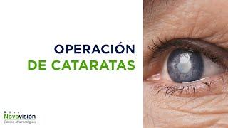 ‍‍ Operación de cataratas: en qué consiste y cómo mejora su visión