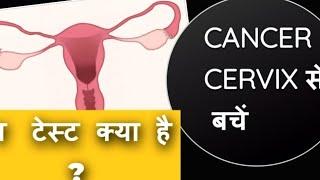 CERVICAL CANCER :early diagnosis, symptoms #cervicalcancersymptoms|#cervicalcancerscreening|#paptest