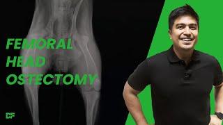 Femoral Head and Neck Ostectomy