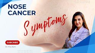 Nose Cancer Symptoms: What You NEED To Know