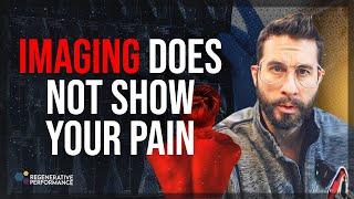 Imaging Does Not Show Your Pain