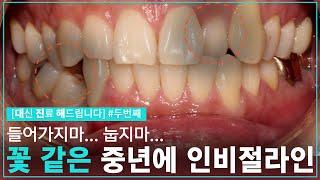 [대진다] 꽃 같은 중년에 인비절라인을 시작하다│#두 번째 이야기