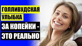  Обзор виниров ⭐ Сколько стоят керамические виниры