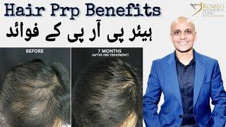 Hair PRP benefits by Dr Romeo Rajput