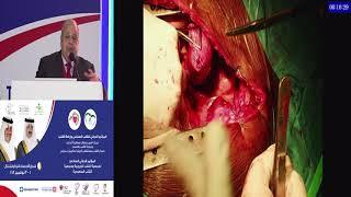 Mohamed Nasr   Repair of Aortic Coarcation in Aduls x264