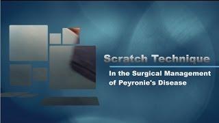 The 'Scratch' Technique to Treat Peyronie's Disease