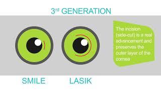 SMILE Laser Vision Correction Explained