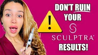 The 5 Biggest Sculptra Mistakes that will RUIN your Results!- Before you get Sculptra Watch This