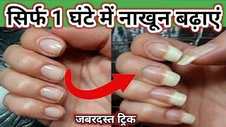 1 Hour Nail Growth Challenge/Live Proof/How to grow nails fast/Fast Nail Growth Tips For Long Nails