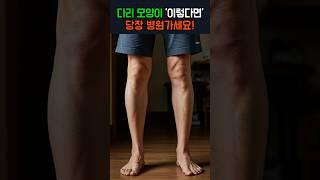 다리 모양이 '이렇다면' 당장 병원가세요! 생명을 위협할 수 있습니다!