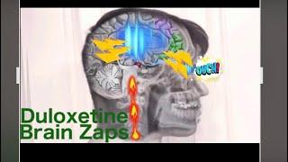 Virtually Experience A Brain Zap: Cymbalta Discontinuation Syndrome