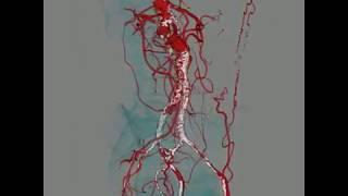 Chronic celiac and SMA occlusion