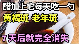 醋加上它每天吃一勺，脸上的老年斑、黄褐斑7天就没了，75岁老中医皮肤跟15岁孙女一样白皙滑嫩，超简单！【饮食养生大智慧】