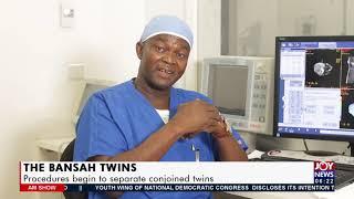 The Bansah Twins: Procedures begin to separate conjoined twins - AM News on Joy News (9-7-21)