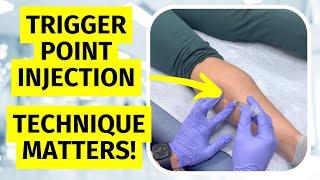 Trigger Point Injection Technique Matters!