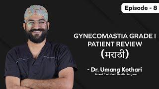 Gynecomastia Grade - 1 Patient Review (मराठी) | Gynecomastia Surgery | Dr. Umang Kothari | Ep - 08