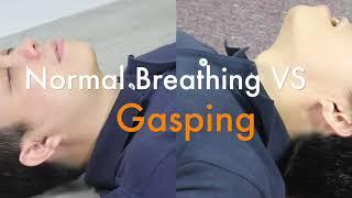 Sudden Cardiac Arrest (SCA) and Agonal Breathing (Gasping)