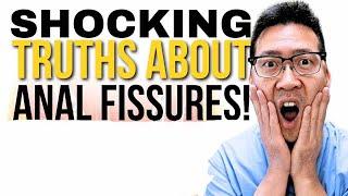 You NEED to know the TRUTH about Anal Fissures!