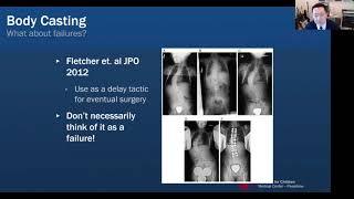 Systematic Approach to Pediatric Spine Deformity Care Webinar