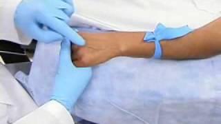 peripheral IV cannulation.1.wmv