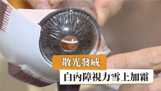 散光發威　白內障視力雪上加霜