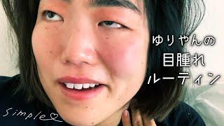 ゆりやんの目腫れルーティン /YURIYAN's Routine ~Puffy eye~