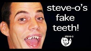 The Untold Story of Steve O's Fake Teeth | Steve-O