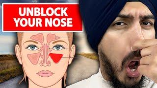 3 Steps to INSTANTLY Unblock Your Nose For Good!