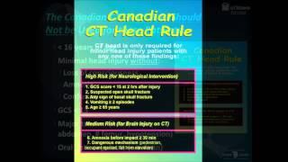 Canadian CT Head Rule by Dr. Ian Stiell