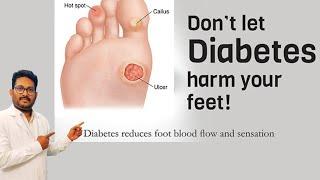 Don’t let diabetes harm your feet! || Inspire life prosthetics and orthotics LLP