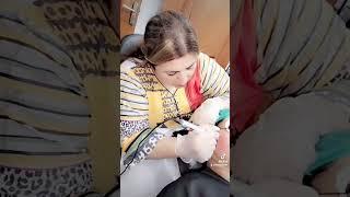 needling