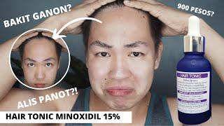 E1 • HAIR TONIC MINOXIDIL 15% REVIEW FOR ONE WEEK! IS IT REALLY EFFECTIVE?!