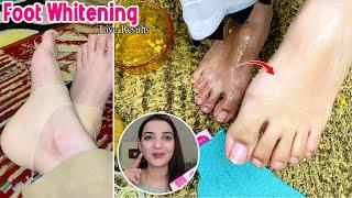 Instant Feet Whitening Successful DIY Tan Removal at Home Easy Steps