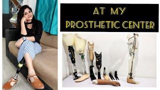 Episode 4 | A Day at my Prosthetic center#Endolite #prosthesis#renjimavishnu