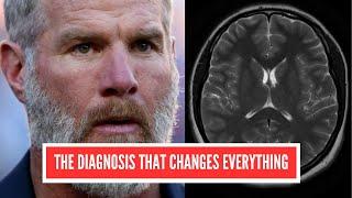 Brett Favre's Parkinson's: Hidden Danger in Football?