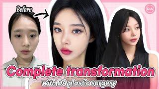 [Plastic Surgery Korea] Complete Transformation!