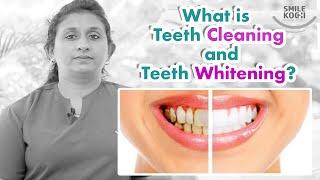 Teeth whitening by Smile Kochi Dental Clinic