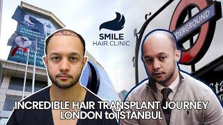 Andrew's Incredible Hair Transformation Journey | UK & Smile Hair Clinic Experience