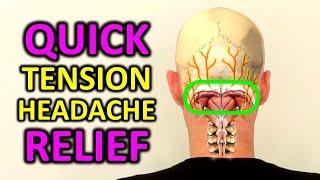 Tension Headache Exercises. Stress Headache Relief in 4 Minutes.