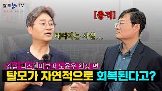 탈모치료 VS 모발이식 중요한 건 바로 이것!