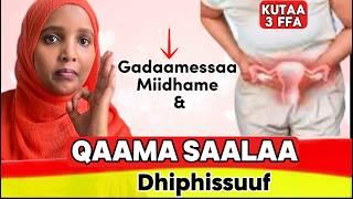 Furmaata miidhama gadameessaa fi qaama saalaa dubartii dhiphissuf(uterine prolapse treatment)