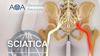 AOA Orthopedic Specialists - Sciatica