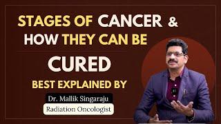 Stages of Cancer & How They Can be Cured | Dr. Mallik Singaraju | Best Radiation Oncologist #cancer