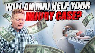 Will An MRI Help My Injury Settlement?