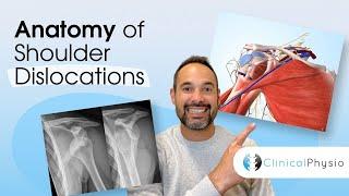 Shoulder Dislocation Anatomy | Expert Physio Guide