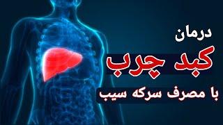 کبدچرب: درمان کبدچرب با مصرف سرکه سیب  #کبدچرب #سرکه_سیب #مسترسلامت